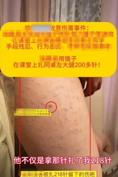 女生被同桌扎数百下