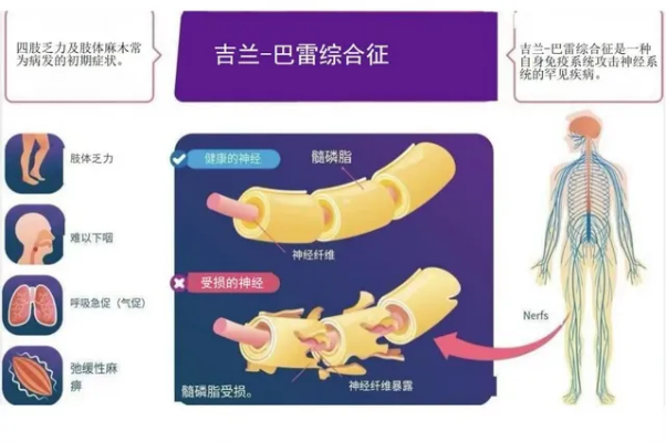 因烧烤进ICU换5次血