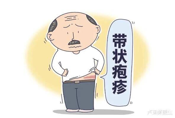 50岁以上为带状疱疹易发人群