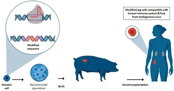 给人类胎儿移植猪肾